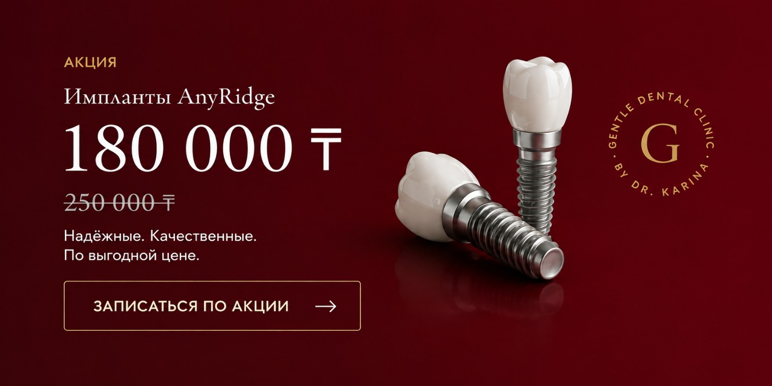 Акция: импланты AnyRidge за 180 000 тенге